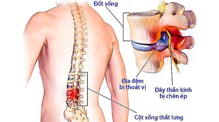 thoat vi dia dem the trung tam 1